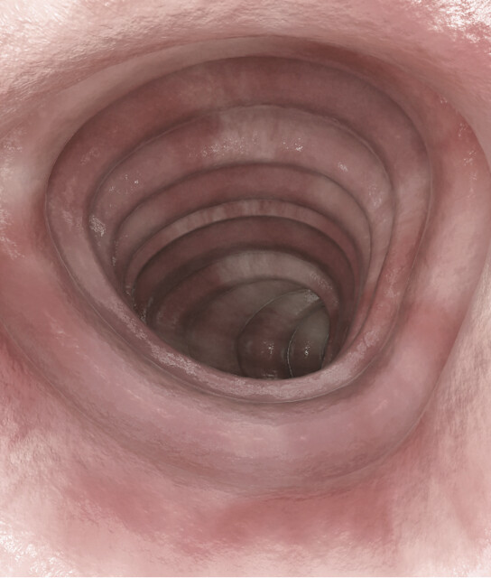 大腸內視鏡檢查影像。腸道殘留物沖洗乾淨的健康狀態