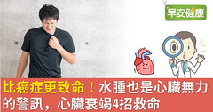比癌症更致命！水腫也是心臟無力的警訊，心臟衰竭4招救命
