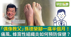 「偶像教父」孫德榮腳一痛半個月！痛風、蜂窩性組織炎如何預防保健？