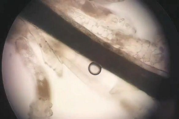 顯微鏡下的蟎蟲，一根睫毛有許多隻蟲。