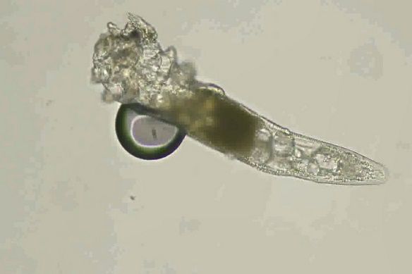 顯微鏡下的蟎蟲特寫。