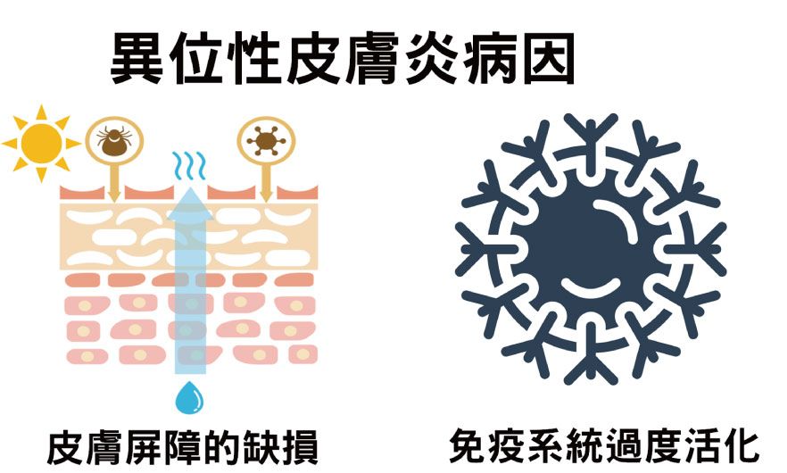 異位性皮膚炎病因