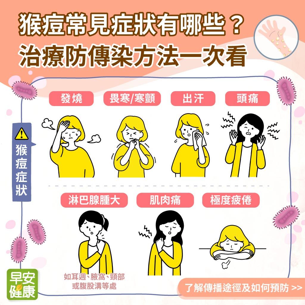 猴痘台灣本土首例確診！發燒、紅疹都是猴痘常見症狀，治療防傳染方法一次看
