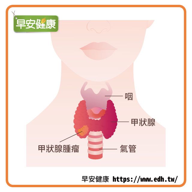 甲狀腺位置在頸部甲狀軟骨下方、氣管兩旁。