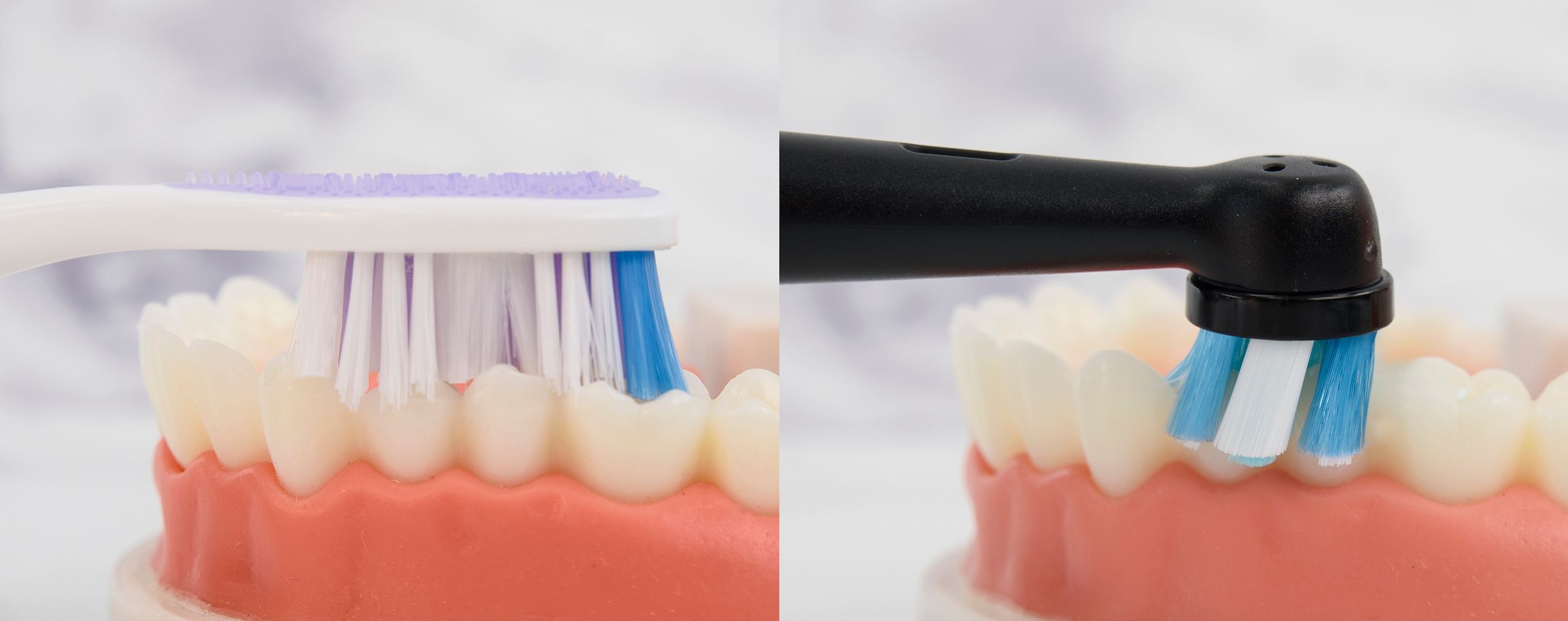 像全球最多牙醫推薦的Oral-B電動牙刷小圓頭就能夠深入死角，貼合半圓形牙齦溝，360º包覆清潔，如下圖圖示可以看到，對比左邊一般長柄牙刷，在刷牙時右邊的小圓頭刷毛能更全面包覆與清潔牙齒。