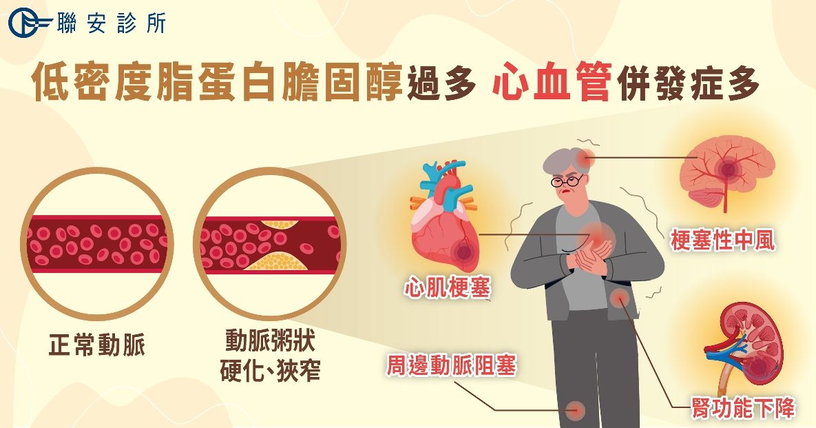 低密度脂蛋白膽固醇過多的問題