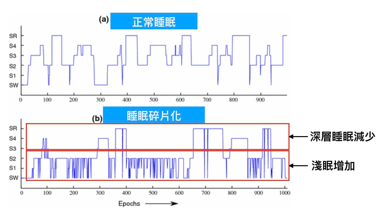 謝慶宏醫師_改善睡眠呼吸中止的益處