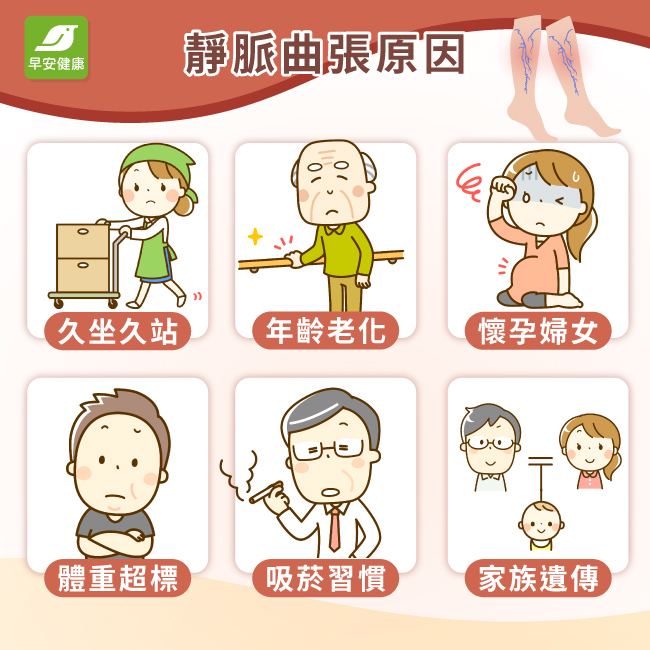 靜脈曲張原因