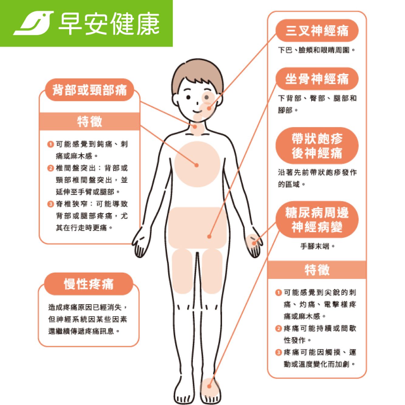 神經性疼痛特徵