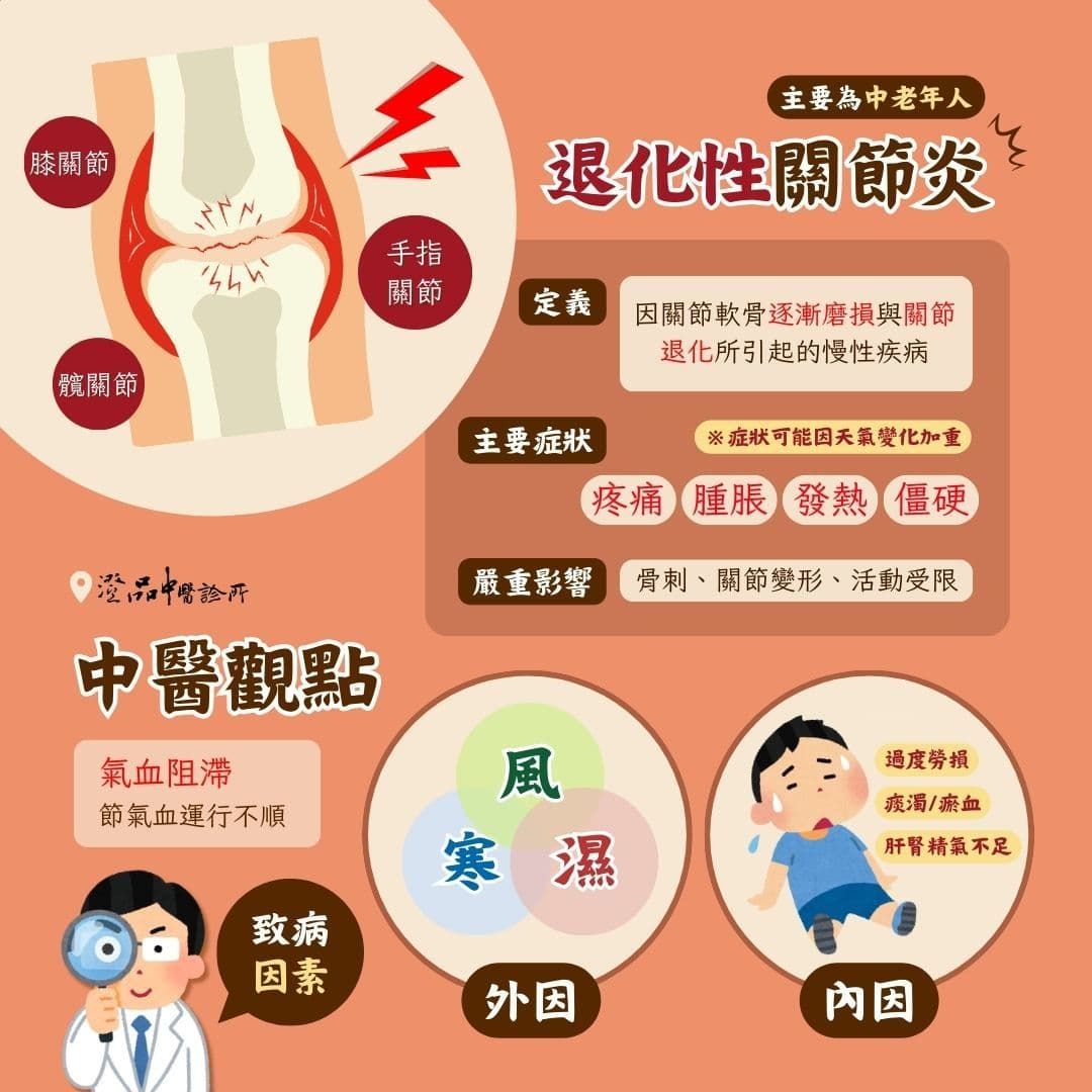 澄品_顏孟章_雨天一來退化性關節炎就來找碴