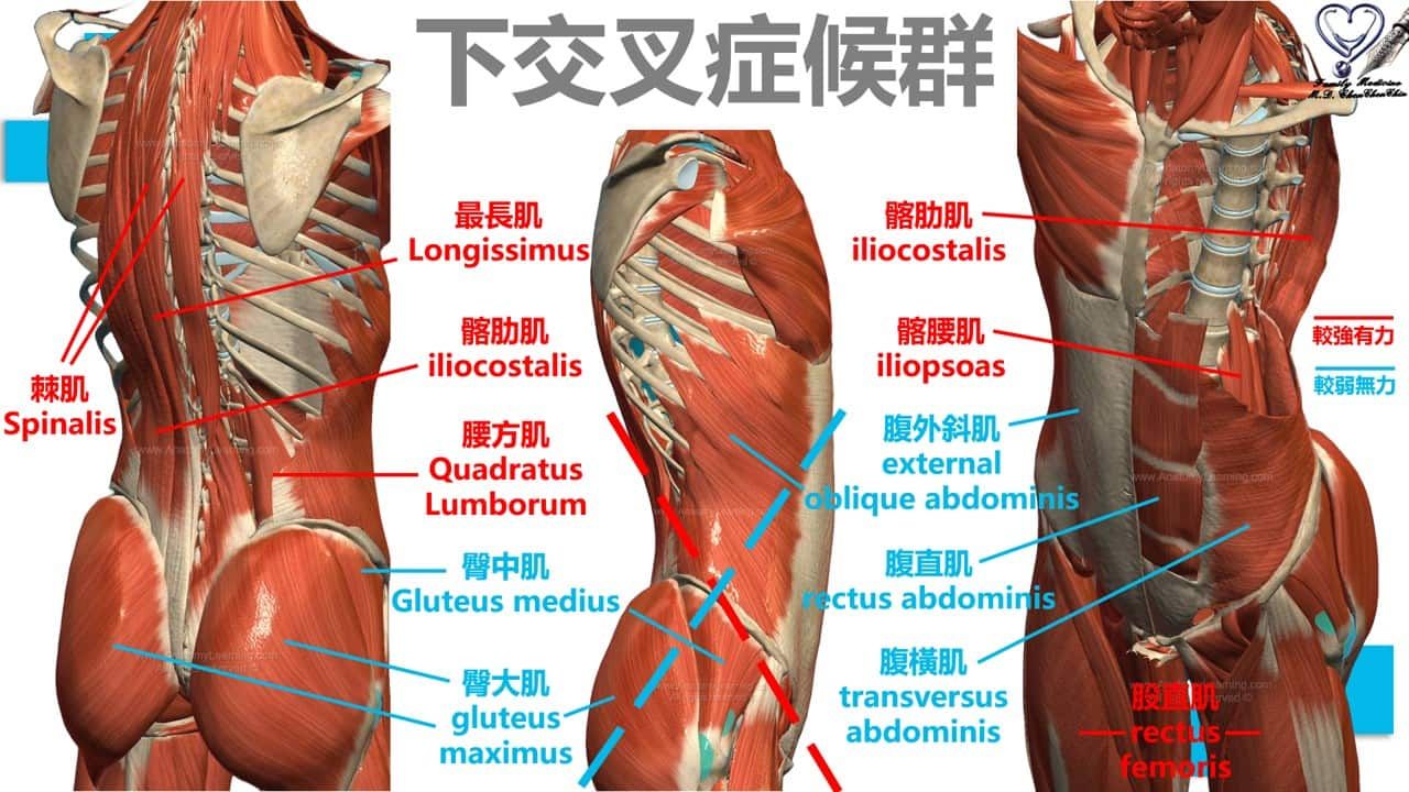 陳承勤醫師_下交叉症候群