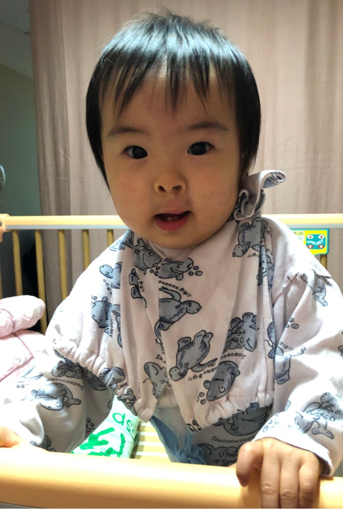 唇腭裂寶寶