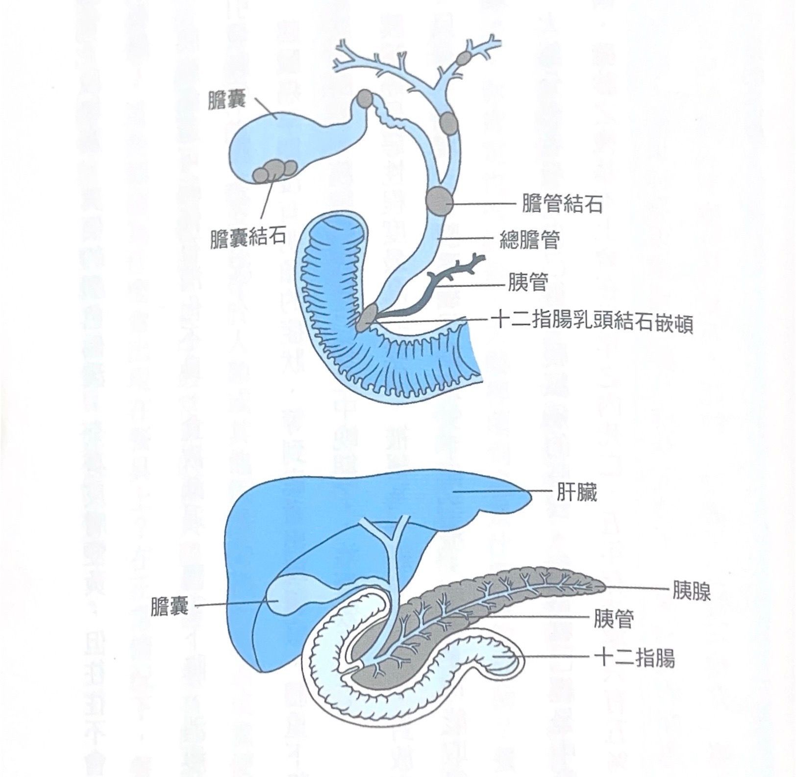 胰臟癌
