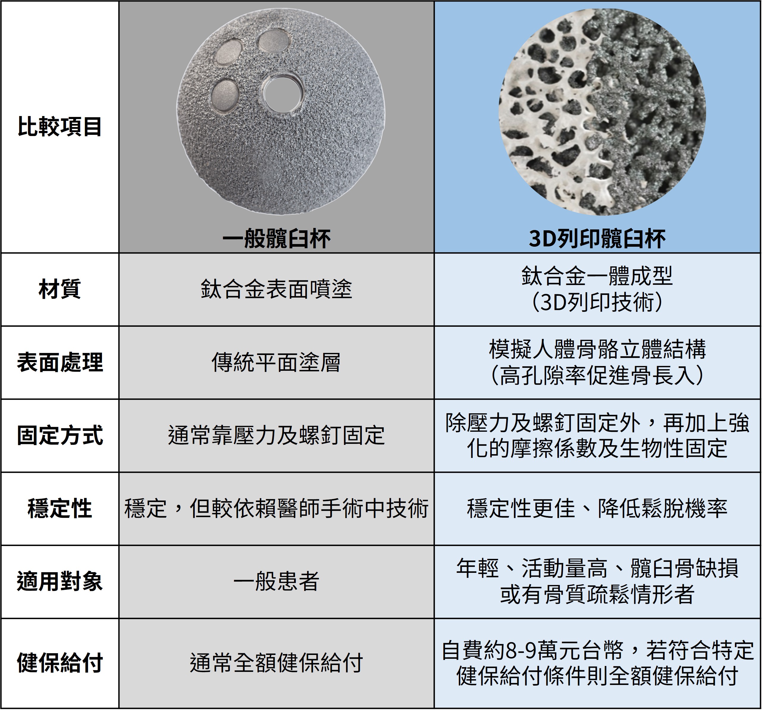 一般髖臼杯VS 3D列印髖臼杯的特點比較