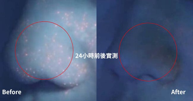 使用理膚寶水Duo+M經過24小時後