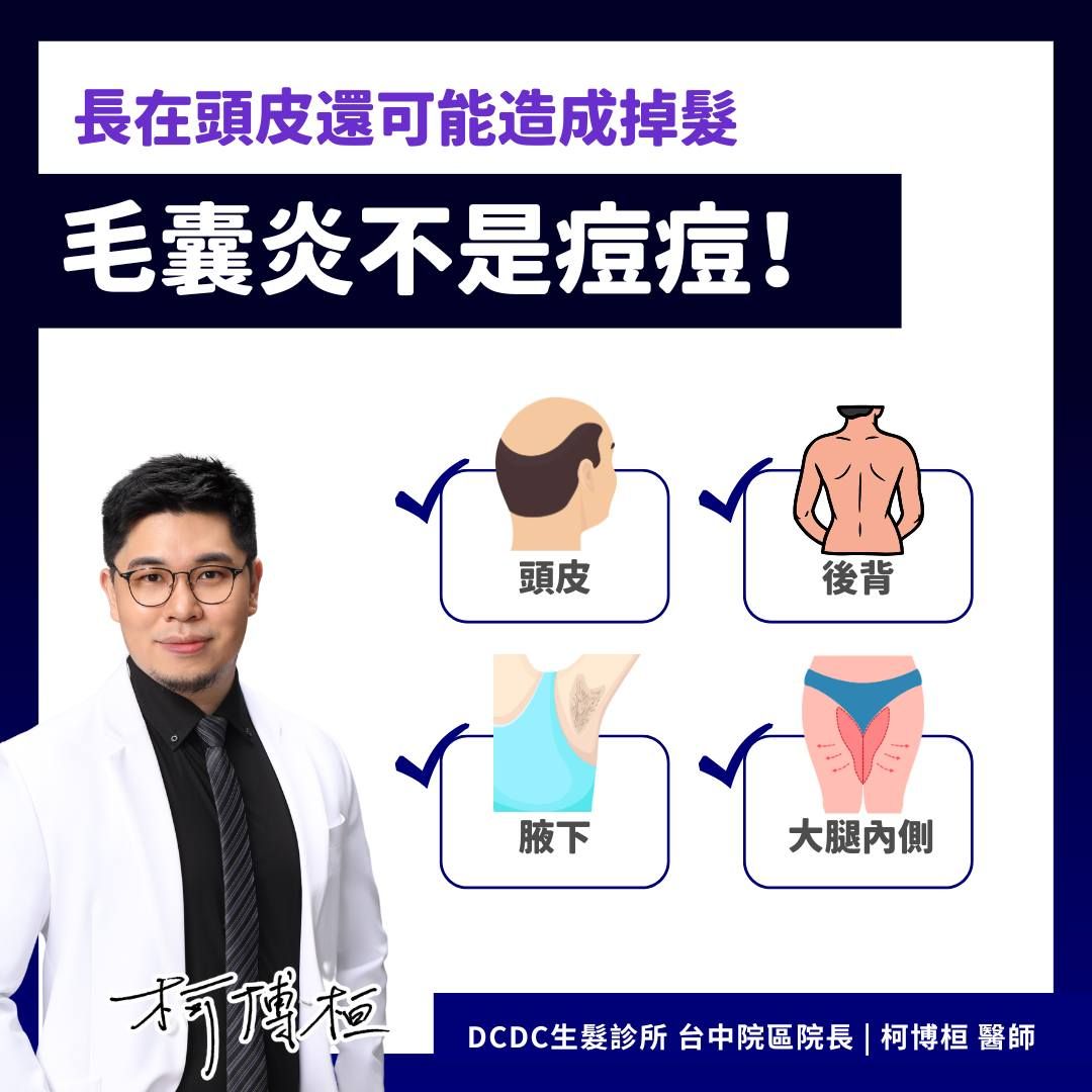 皮膚科柯博桓醫師_毛囊炎不是痘痘