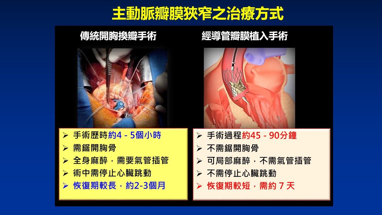導管主動脈瓣膜植入術(TAVR),成為高齡或高手術風險患者的救命曙光
