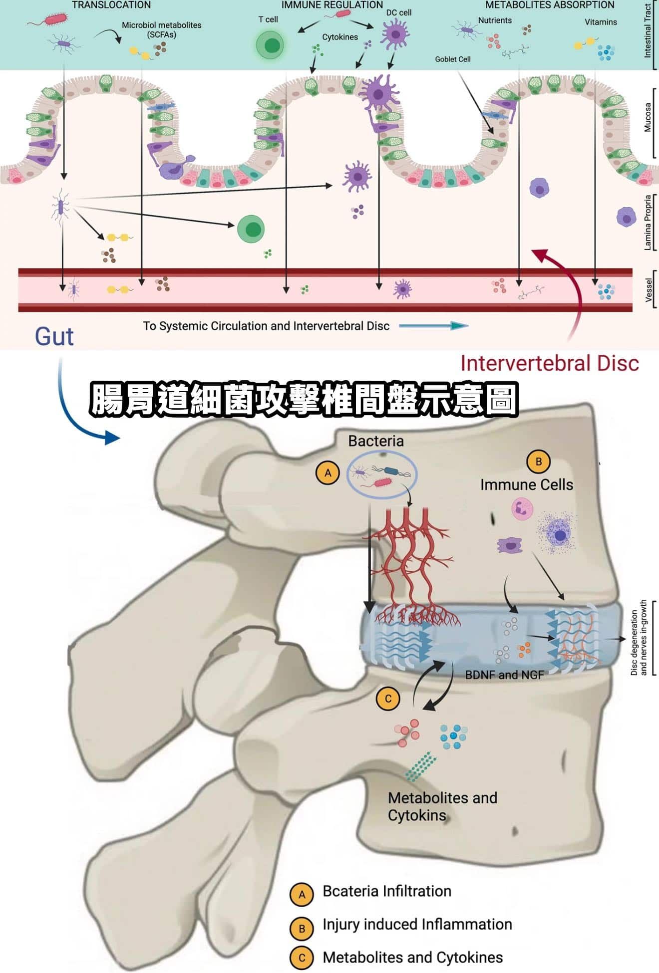 徐國峰醫師_細菌攻擊腸道