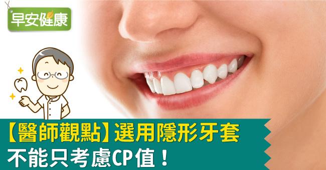 【醫師觀點】選用隱形牙套 不能只考慮CP值！