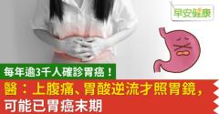 每年逾3千人確診胃癌！醫：上腹痛、胃酸逆流才照胃鏡，可能已胃癌末期
