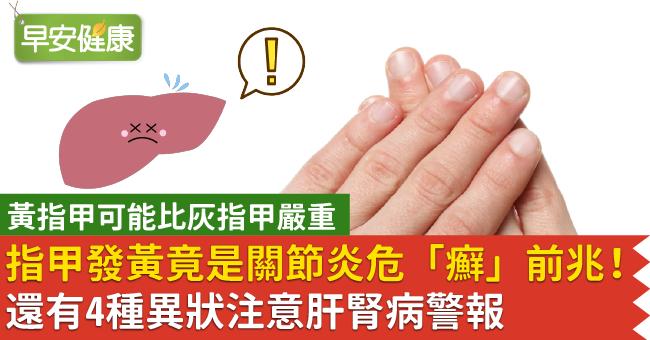 指甲發黃竟是關節炎危「癬」前兆！還有4種異狀注意肝腎病警報