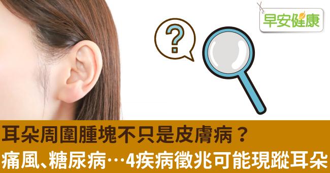 耳朵周圍腫塊不只是皮膚病？痛風、糖尿病…4疾病徵兆可能現蹤耳朵