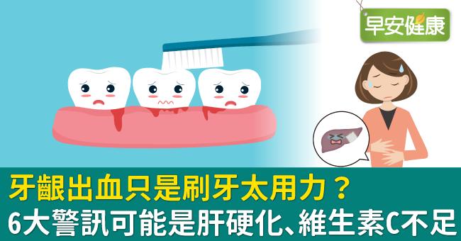 牙齦出血只是刷牙太用力？6大警訊可能是肝硬化、維生素C不足