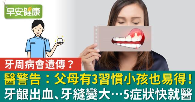 牙周病會遺傳？醫警告：父母有3習慣小孩也易得！牙齦出血、牙縫變大…5症狀快就醫