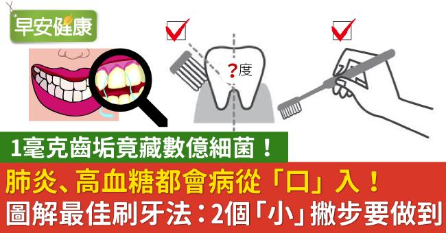 1毫克齒垢竟藏數億細菌！肺炎、高血糖都會病從「口」入，圖解最佳刷牙法：2個「小」撇步要做到
