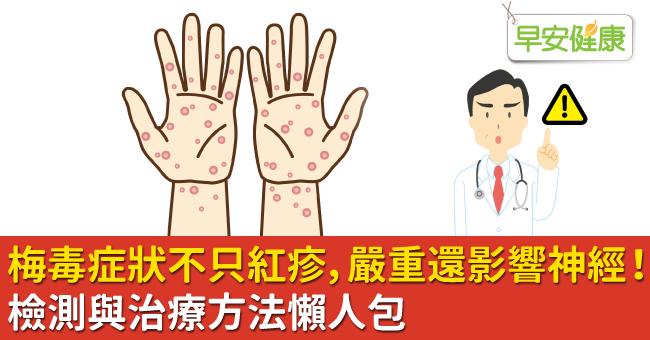 梅毒症狀除了初期皮膚紅疹還有哪些？被傳染梅毒會好嗎？潛伏期多久？檢驗與根治治療方法懶人包