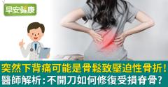 突然下背痛可能是骨鬆致壓迫性骨折！醫師解析：不開刀如何修復受損脊骨？