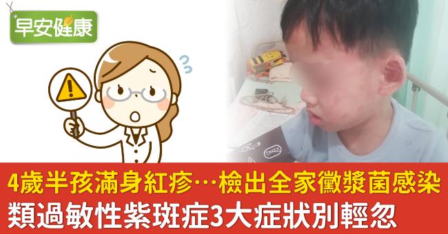 4歲半孩滿身紅疹…檢出全家黴漿菌感染！類過敏性紫斑症3大症狀別輕忽