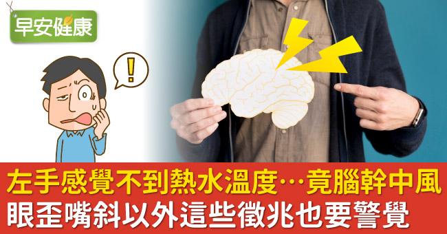 左手感覺不到熱水溫度…竟腦幹中風！眼歪嘴斜以外這些徵兆也要警覺