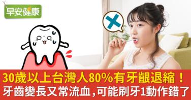 30歲以上台灣人80％有牙齦退縮！牙齒變長又常流血，可能刷牙1動作錯了