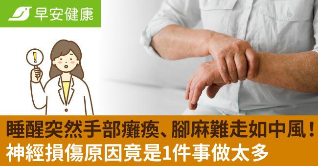 睡醒突然手部癱瘓、腳麻難走如中風！神經損傷原因竟是1件事做太多