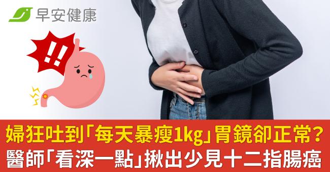 婦狂吐到「每天暴瘦1kg」胃鏡卻正常？醫師「看深一點」揪出少見十二指腸癌