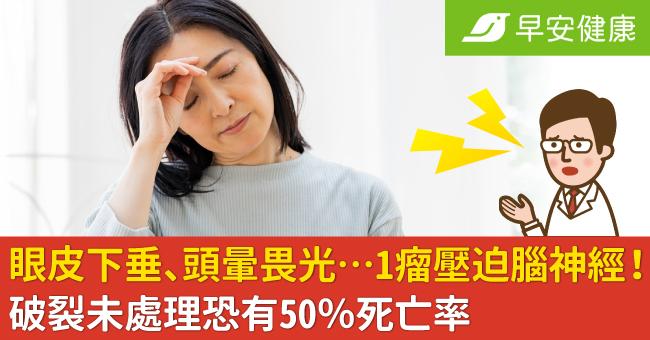 眼皮下垂、頭暈畏光…1瘤壓迫腦神經惹禍！破裂未處理恐有50％死亡率