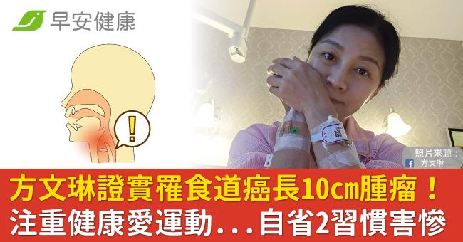 方文琳證實罹食道癌長10cm腫瘤！注重健康愛運動...自省2習慣害慘