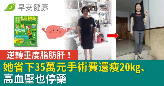 逆轉重度脂肪肝！她省下35萬元手術費還瘦20kg、高血壓也停藥