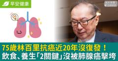 75歲林百里抗癌近20年沒復發！飲食、養生「2關鍵」沒被肺腺癌擊垮