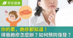 唇皰疹會傳染嗎？嘴唇皰疹多久會好？教你怎樣讓唇皰疹快點好又防復發