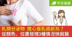 乳頭分泌物會是乳癌前兆嗎？從顏色、位置看「3種情況」快就醫