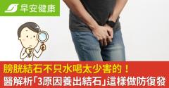 膀胱結石不只水喝太少害的！醫解析「3原因養出結石」這樣做防復發