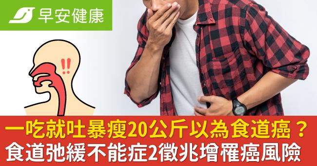 一吃就吐暴瘦20公斤以為食道癌？食道弛緩不能症2徵兆增罹癌風險