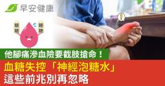 他腳痛滲血險要截肢搶命！血糖失控「神經泡糖水」這些前兆別再忽略