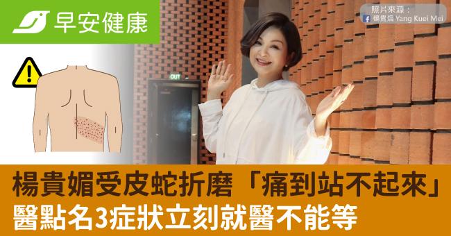 楊貴媚受皮蛇折磨「痛到站不起來」醫點名3症狀立刻就醫不能等