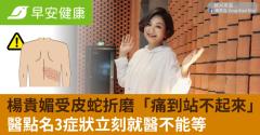 楊貴媚受皮蛇折磨「痛到站不起來」醫點名3症狀立刻就醫不能等