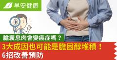 膽囊息肉會變癌症嗎？3大成因也可能是膽固醇堆積！6招改善預防