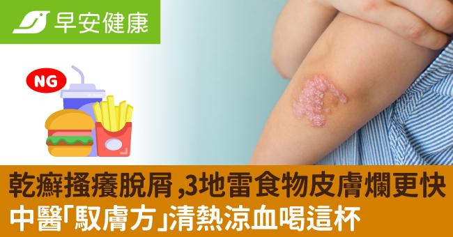 乾癬搔癢脫屑，3地雷食物皮膚爛更快！中醫「馭膚方」清熱涼血喝這杯