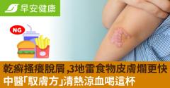 乾癬搔癢脫屑，3地雷食物皮膚爛更快！中醫「馭膚方」清熱涼血喝這杯